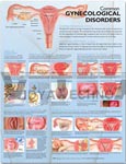 Common Gynecological Disorders Anatomical Chart